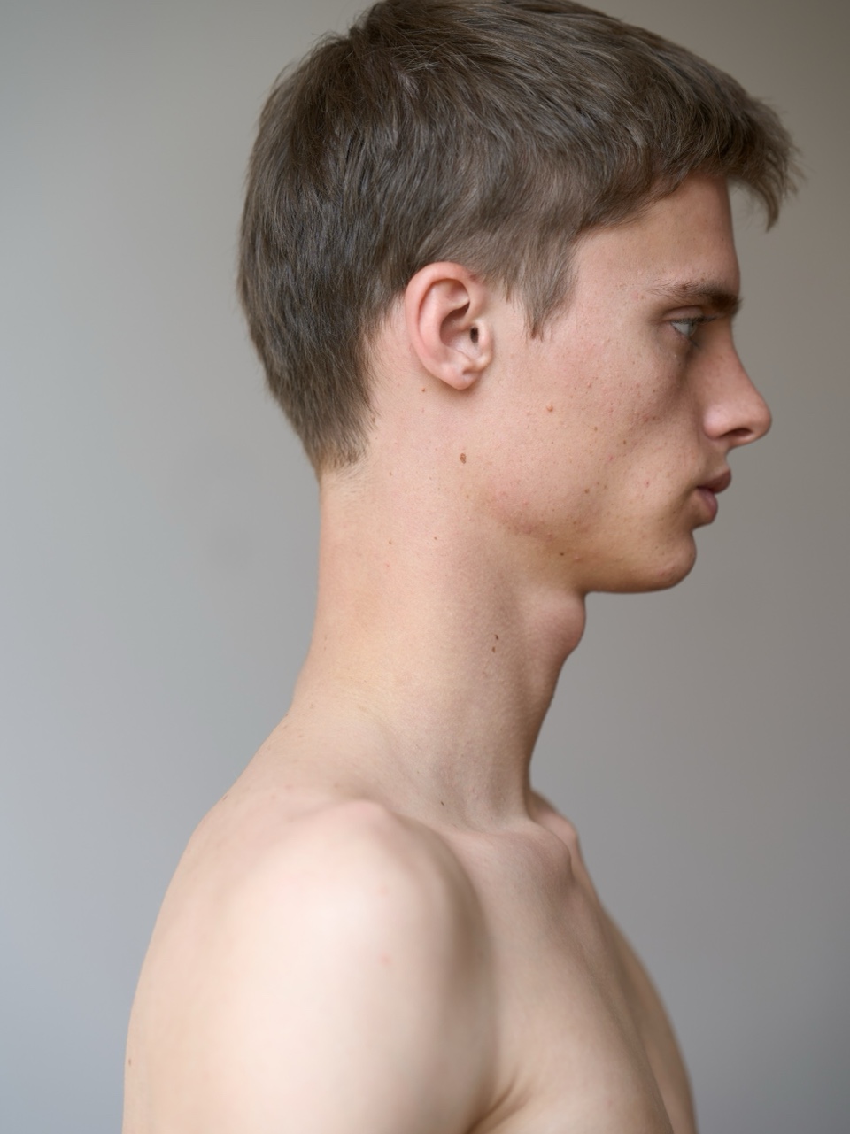 Elias Monstrey - Image 2 Part 1